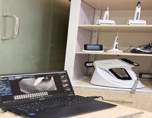 زرعات الأسنان في العيادة السنية