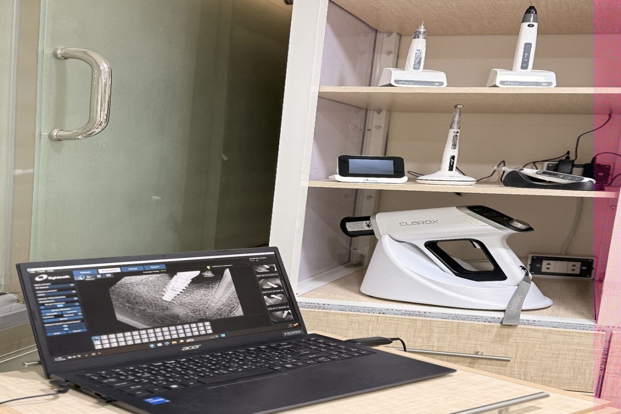 زرعات الأسنان في العيادة السنية